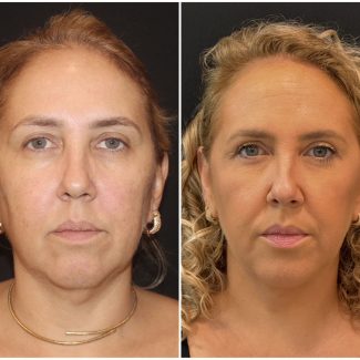 WhatsApp Image 2025-02-05 at 14.45.21 (2)