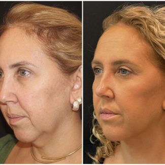 WhatsApp Image 2025-02-05 at 14.45.22