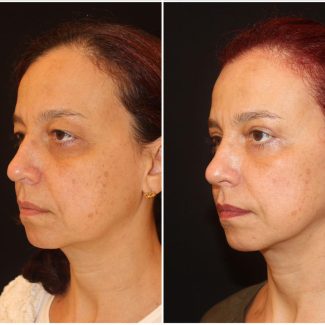 WhatsApp Image 2025-02-05 at 14.49.13